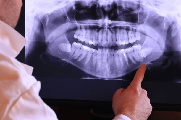 Best Emergency Dental Care for Trauma or Injury in Ellinwood, KS