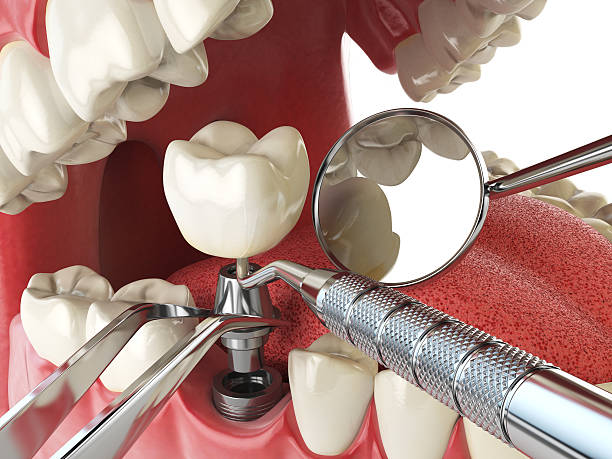 Best Same-Day Emergency Dentist in Ellinwood, KS