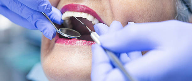 Best Emergency Tooth Extraction in Ellinwood, KS